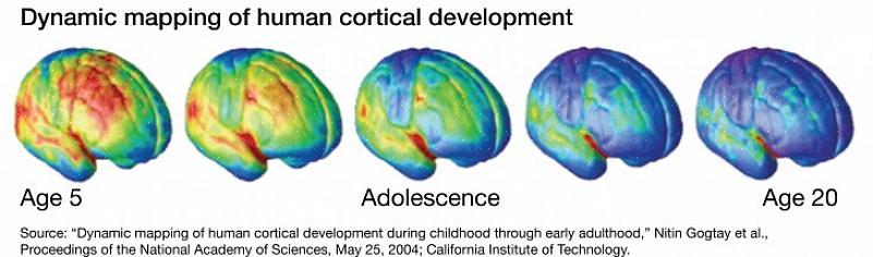אז איך פועל המוח של המתבגר וכיצד הוא מתפתח