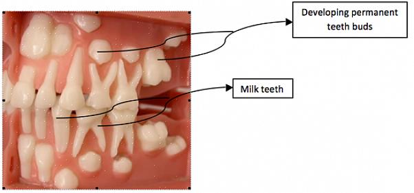 כדי לשמור על שיני חלב בריאות