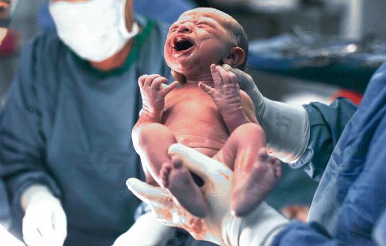 בדיוק כמו איך רופאים לא יודעים כמה כאב מרגישים תינוקות יורדים בתעלת הלידה