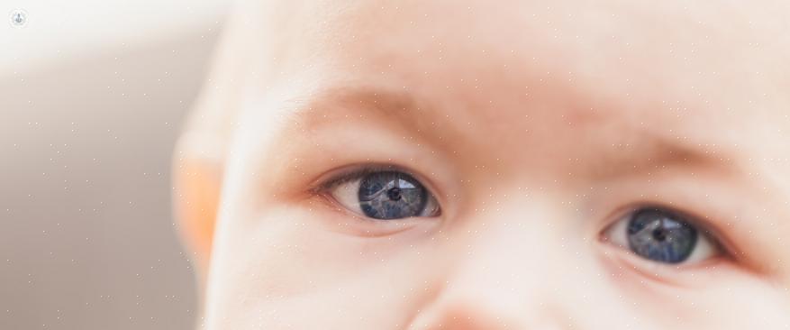 עין עצלה אצל ילדים משפיעה בדרך כלל על עין אחת