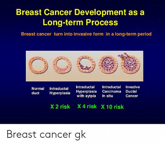 סרטן השד מתחיל לאחר צמיחה לא תקינה של תאי שד הגורמים לגידול להתבטא