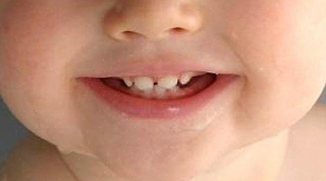 שיני החלב עשירות גם בתאי גזע