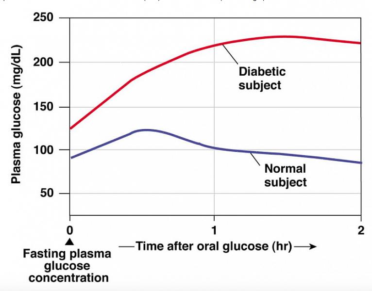 עקומת הסבילות לגלוקוז היא בדיקה חשובה לאיתור סוכרת מסוג 2