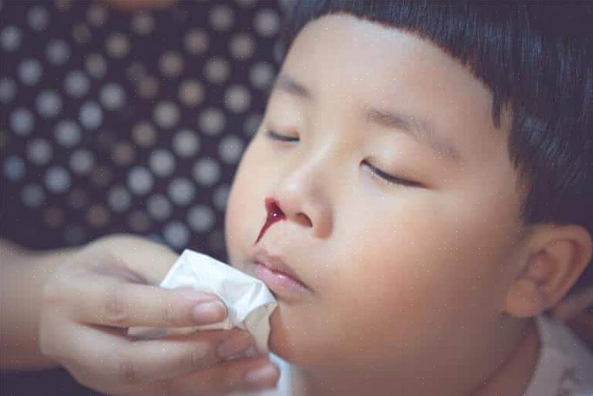 למרות שדימומים מהאף אצל ילדים יכולים להיראות דרמטיים