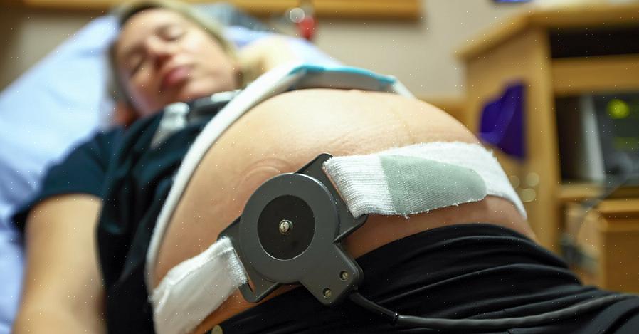 ניטור העובר מאפשר למומחה להעריך את התגובה הפיזיולוגית של התינוק להתכווצויות רחם אמיתיות או התכווצויות לידה
