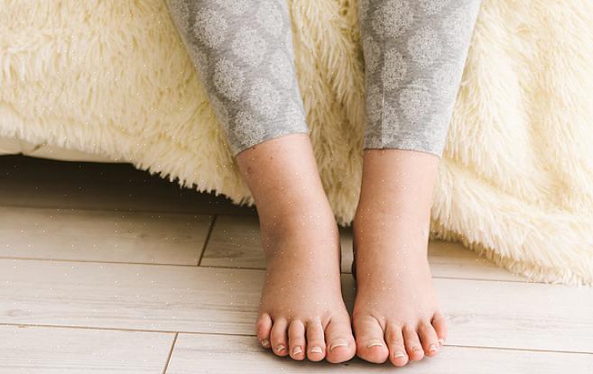 כיצד לשפר רגליים נפוחות לאחר לידה